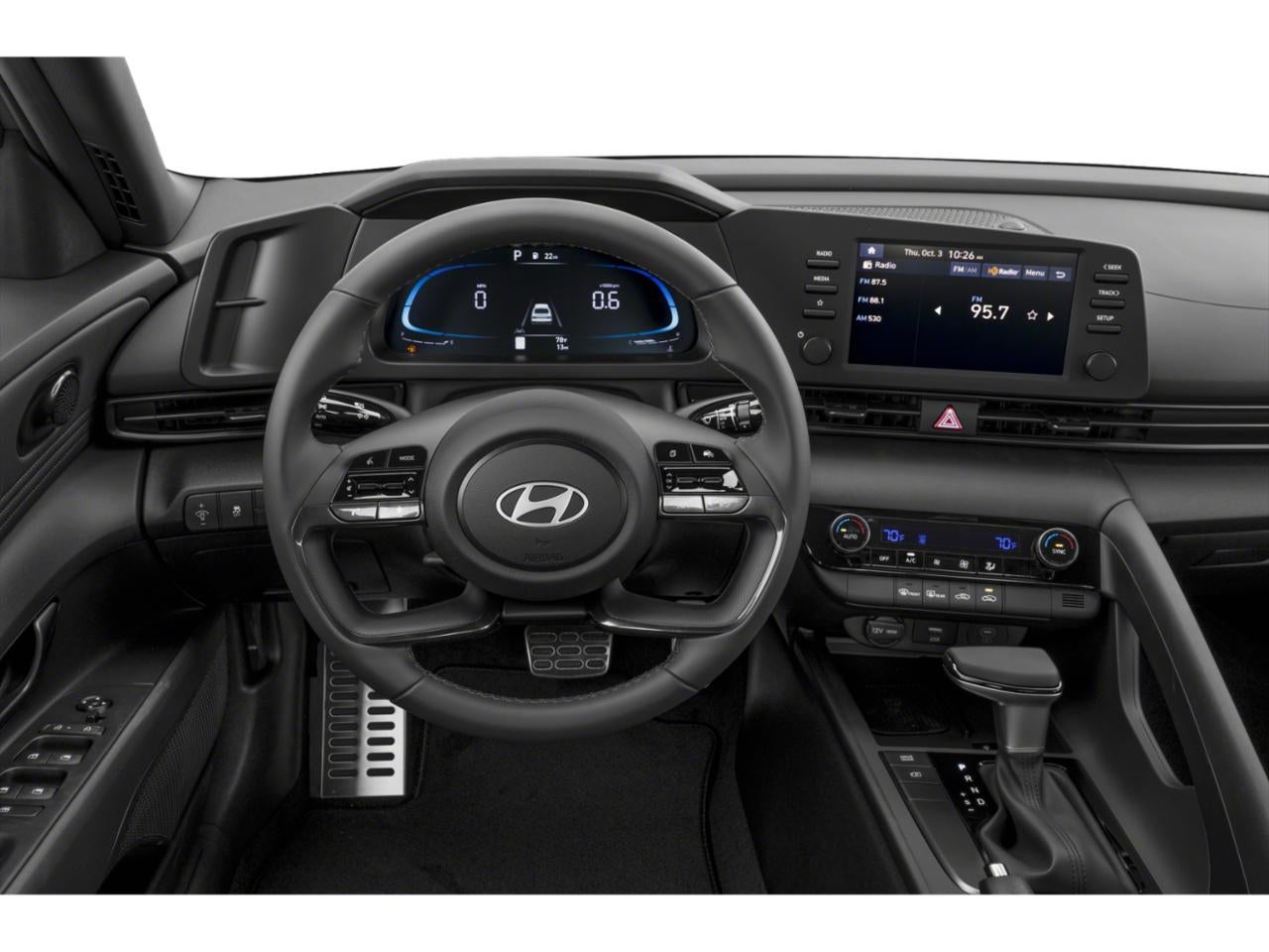 2025 Hyundai ELANTRA SEL Convenience